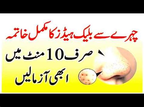 Blackhead Khatam Karne Ka Asan Gharelu Ilaj How To Remove Blackheads