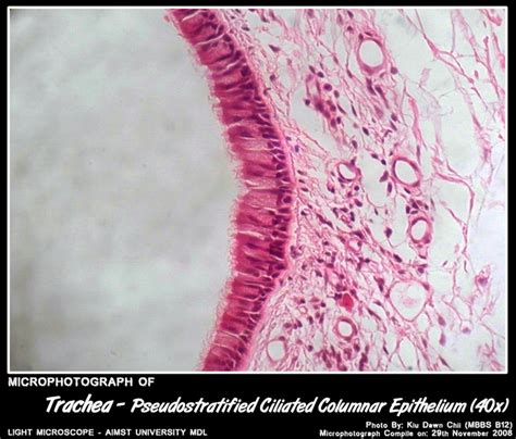 List 105 Pictures Which Structure Is Lined By A Ciliated Epithelium