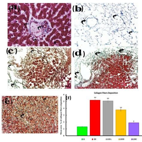 A Photomicrograph Of Massons Trichrome Stained Sections In Normal Download Scientific Diagram