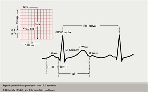 Normal Qrs Time