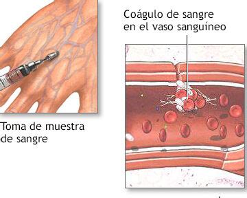 Co Gulos Sangu Neos En La Orina Causas Y Tratamiento