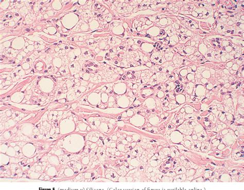 Lip Filler Histology