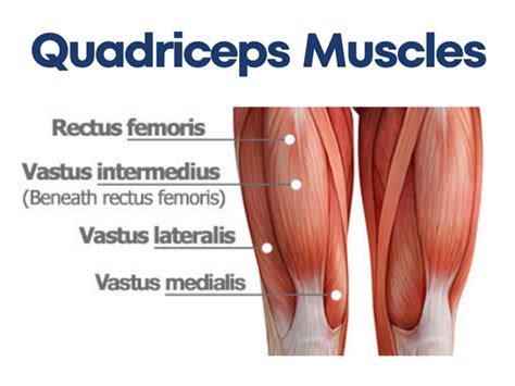 Quadriceps Tendonitis A Comprehensive Guide To Causes Treatments An