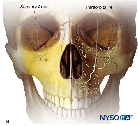 Infraorbital Nerve