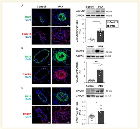 Increased Expressions Of Cxcl Cxcr And Cxcr In Lungs Of Patients