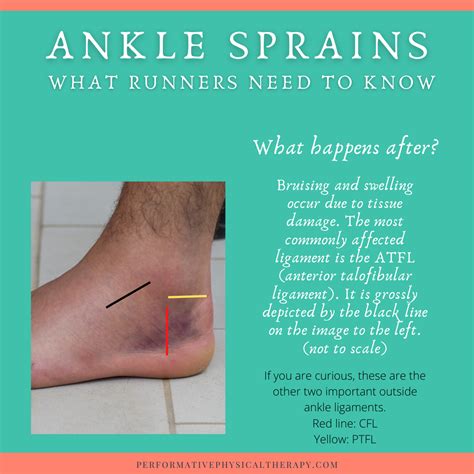 Performative Physical Therapy Ankle Sprains What Runners Need To Know
