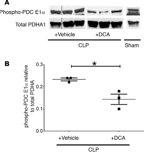 Figure 1 From Pyruvate Dehydrogenase Complex Stimulation Promotes