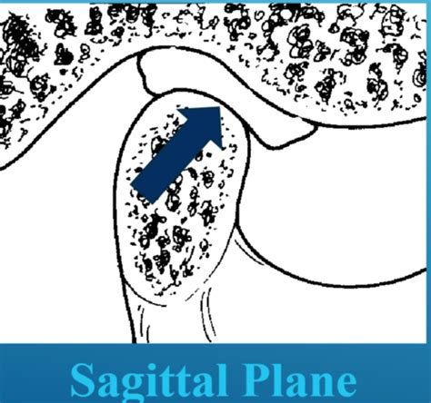 Occlusion Midterm Mandibular Movement Flashcards Quizlet