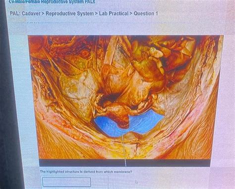 Solved Pal Cadaver Reproductive System Lab Practical Chegg