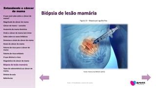 Aula 1 Entendendo O Cancer De Mama 2018 PPT