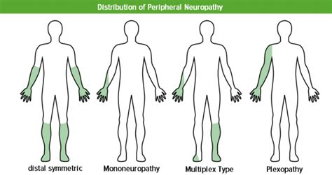 Polyneuropathy Hereditary And Acquired Type Medical Library