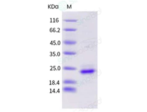 Sino Biological Human K Ras K Ras G C Q Protein His Tag Ug