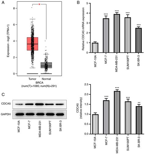 CDCA5 Is Upregulated In Breast Cancer Tissues And Cell Lines A Gene