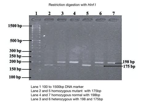 Part 2 Analysing And Interpreting Agarose Gel Electrophoresis Results