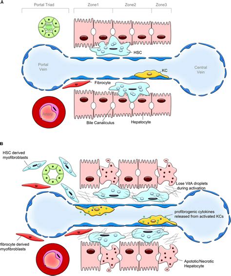 Pathogenesis Of Liver Fibrosis A Hepatic Lobular Structure Under