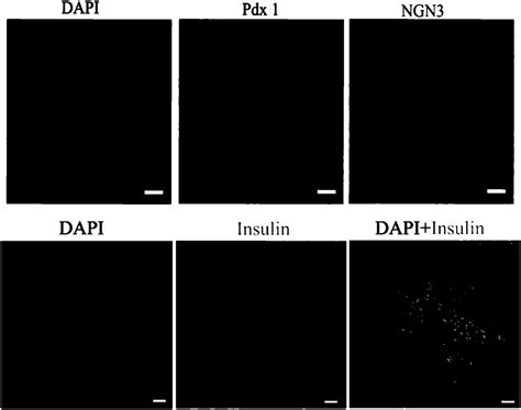 In Vitro Preparation Method Of Pancreas Islet Beta Cell Eureka