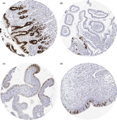 Mucin 5ac Muc5ac Staining In Normal Tissues A Stomach Corpus B