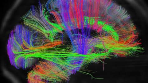 Scans Reveal Intricate Brain Wiring Bbc News