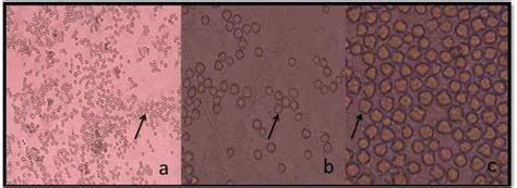 Acanthamoeba Cysts Cultivated From Water Samples In Inverted Download Scientific Diagram