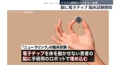 マスク氏創業のベンチャー企業、“脳に電子チップ”臨床試験開始 脳の信号読み取り機械操作目指す ライブドアニュース