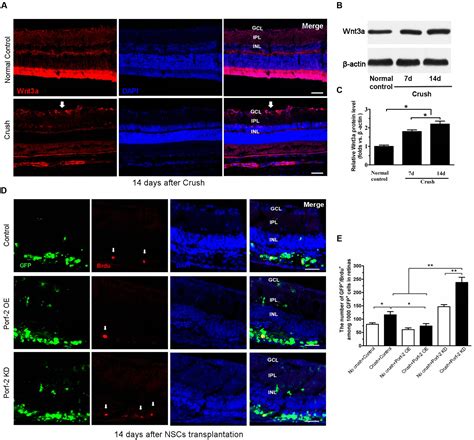 Frontiers Rac1 Guides Porf 2 To Wnt Pathway To Mediate Neural Stem