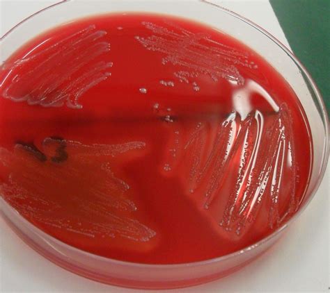 Filestreptococcus Pyogenes Enterokokken Wikimedia Commons