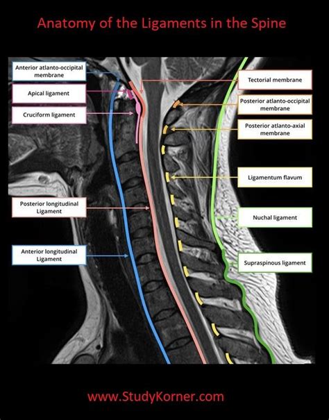 Ligamentum Flavum Thickening Cervical Spine - Facet Hypertrophy And ...