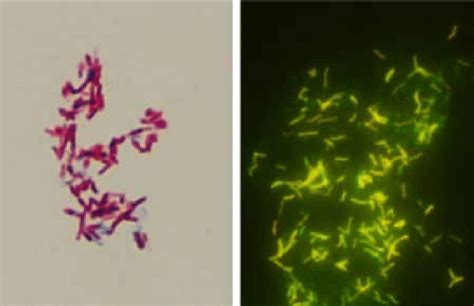 M Tuberculosis Stains Acid Fast Carbol Fuchsin Stain On The Left Download Scientific