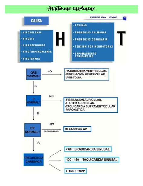 Electrocardiograf A B Sica Arritmias Card Acas Jess Udocz