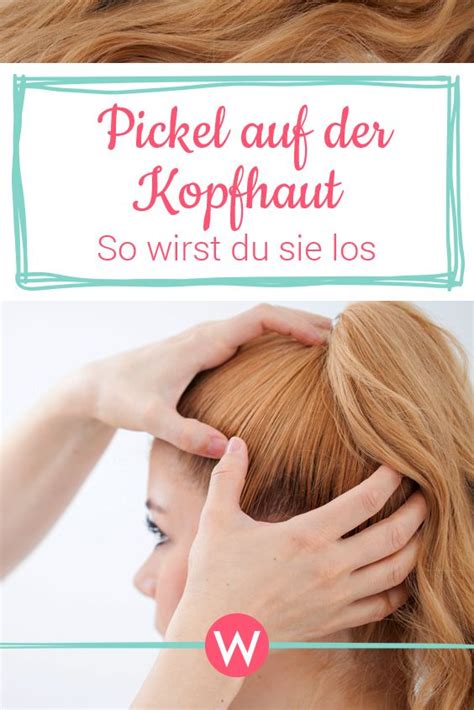 Pickel Auf Der Kopfhaut Ursache Symptome Und Heilung Pickel Auf Der