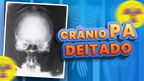 Posicionamento Pa De Cr Nio Dec Bito Radiologando Youtube