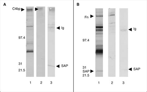 Serum Amyloid P Component Does Not Circulate In Complex With C Binding