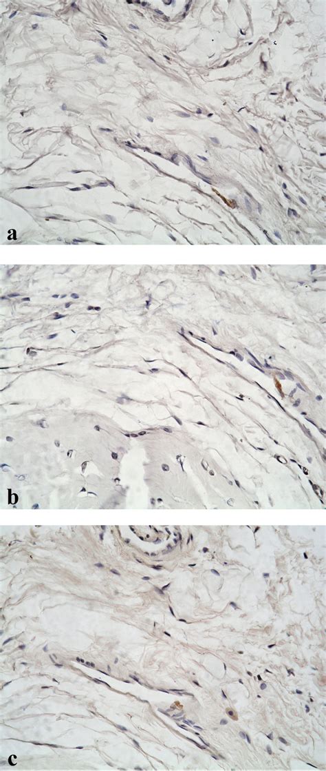 Immunohistochemical Localization Of Collagen Type I A Type Iii B