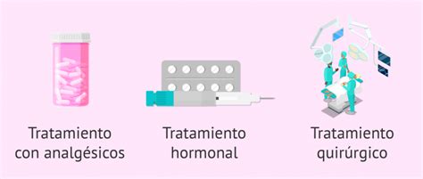 Endometriosis localización síntomas diagnóstico y tratamiento