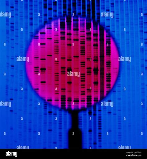 Dna Autoradiogram Magnifying Glass Over A Dna Deoxyribonucleic Acid