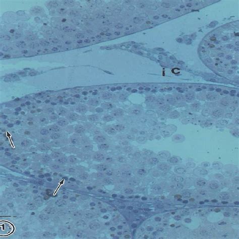 Photomicrograph Of Rat Testis In The Control Group Showing Spermatozoa