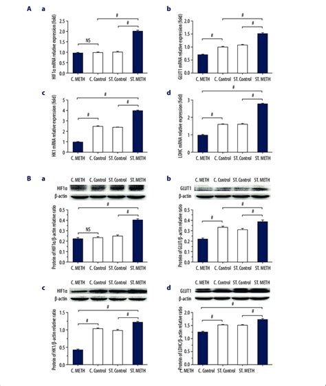 Relative Mrna And Protein Expression Levels Of Hif A Glut Hk And