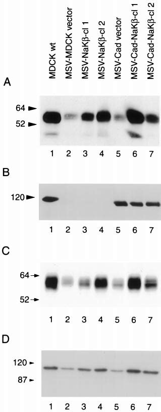 Analysis Of The Expression Of Na K ATPase And Subunits And E Cadherin