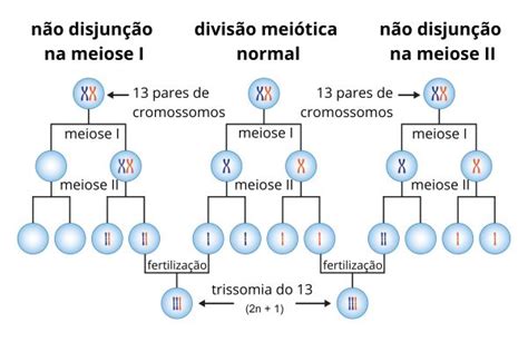 sindrome de patau tempo de vida Descubra a emoção das apostas online