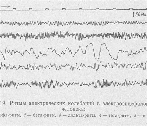 Ритмы при ЭЭГ — обозначение и расшифровка
