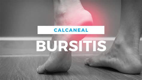 Top-Rated Bursitis Treatment Options - Richmond, VA