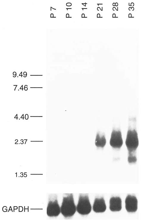 Temporal Pattern Of Expression Of Cux 1 In The Prepubertal Testis