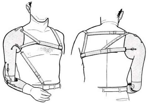 Fig 26 Shoulder Disarticulation Harness Uti Oandp Digital Resource