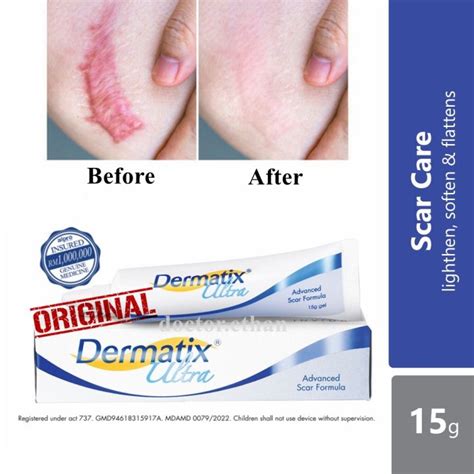 Dermatix Ultra Scar Gel Advance Scar Formula Removal Repair Scar Acne