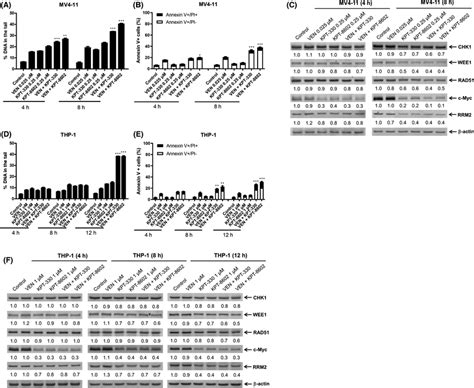 Venetoclax Enhances Dna Damage Induced By Xpo Inhibition In Aml Cells