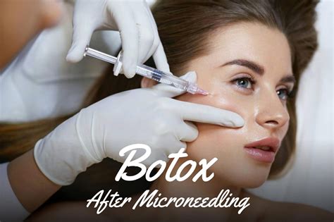 Can I Get Botox After Microneedling Fitness Beauty Art