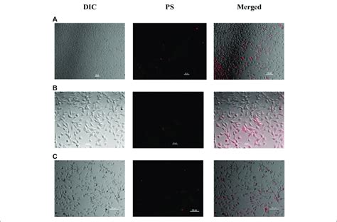 From Left To Right Differential Interference Contrast Dic And