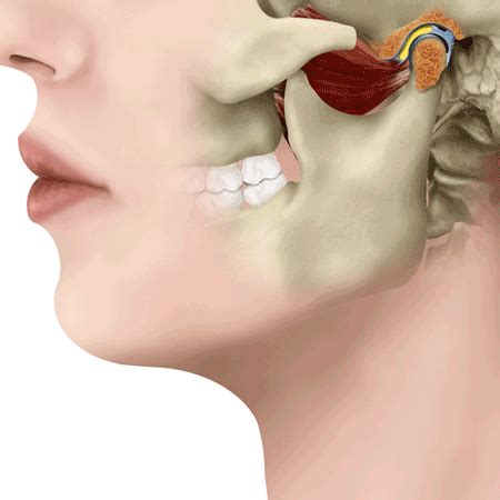 Unlocking Relief Effective TMJ Treatment Techniques You Need To Know