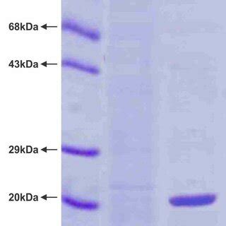 Sds Page Analysis Of E Coli Bl De Plyss Expressed Cell Lysate Lane