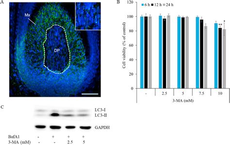 3 MA Inhibits Autophagy In HDPCs A LC3 Puncta In The Anagen Human